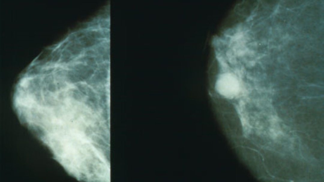 Jinsiy aloqa Bryansk tel 8960