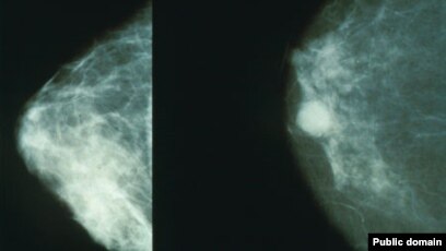 Pavlogradda ayollar uchun jinsiy aloqa Oyoqsiz ayol bilan jinsiy aloqa video