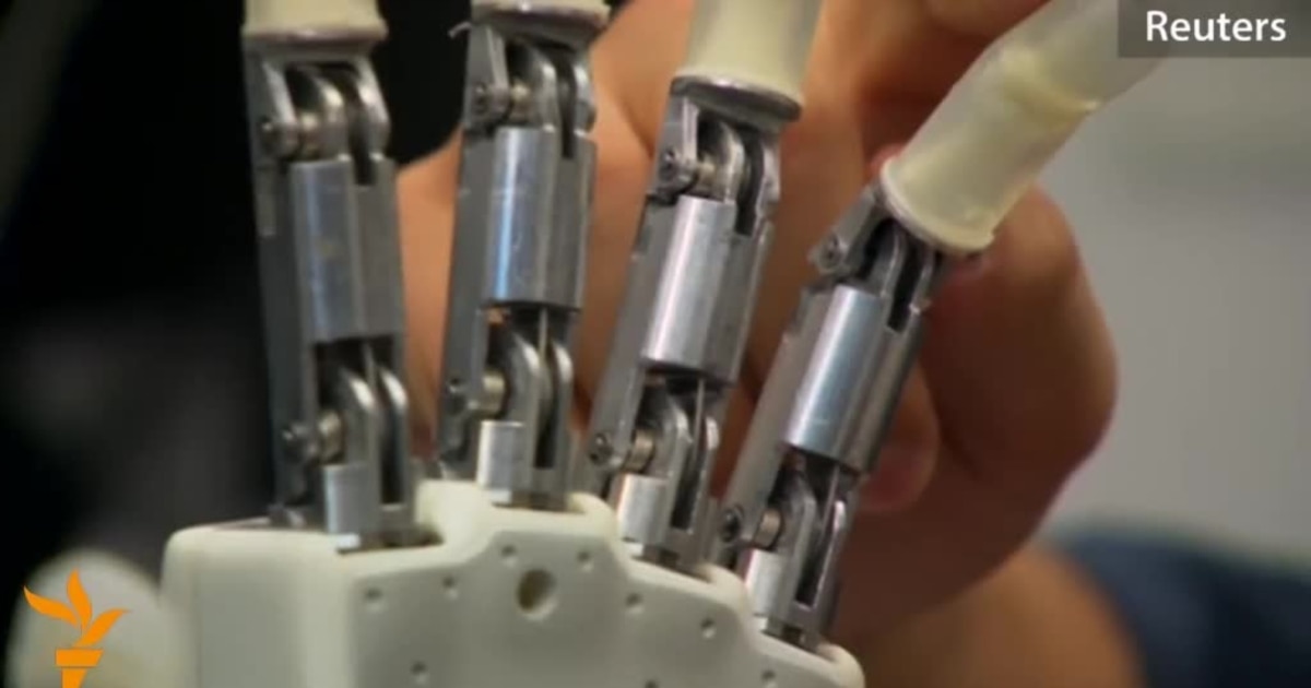 Amputee 'Feels' Objects With Prototype Bionic Hand