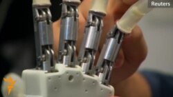 Bionic Hand Gives Amputees A New Sense Of Touch