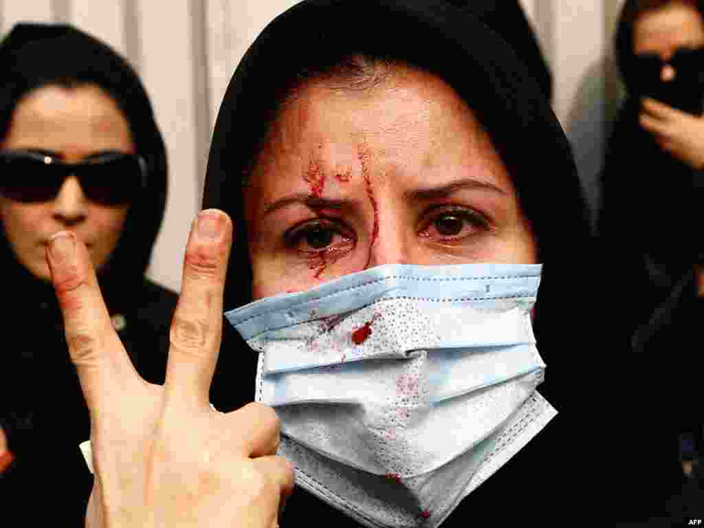 An injured Iranian opposition supporter flashes a victory sign during clashes with security forces in Tehran on December 27. At least eight protesters were killed in the clashes.