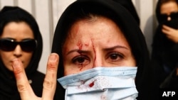 An injured Iranian opposition supporter flashes a V-sign during clashes with security forces in Tehran on December 27.