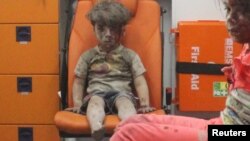 Beş yaşlı Omran Daqneesh