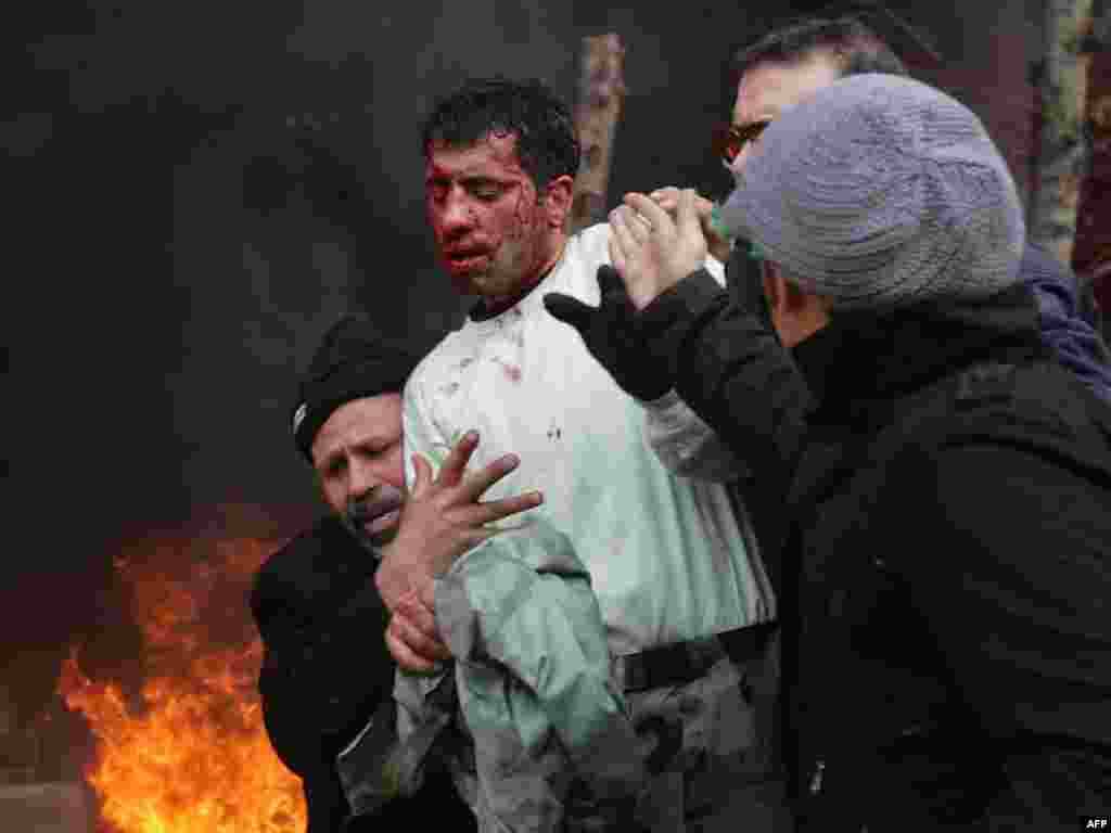 An injured police officer is helped away from the scene. (AFP)