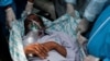 کووېډ-۱۹ وبا د هند روغتیايي نظام له لوی فشار سره مخامخ کړی