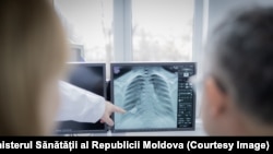 O serie de tumori maligne, cum ar fi cele pulmonare, pancreatice, de ficat sau ale căilor biliare, renal și de prostată, vor putea fi diagnosticate și tratate minim invaziv prin acces natural.