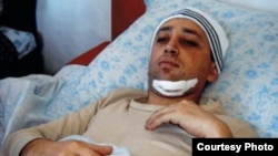 Журналист Фикрат Гусейнов после нападения на него в Азербайджане. Баку, 2006 год.