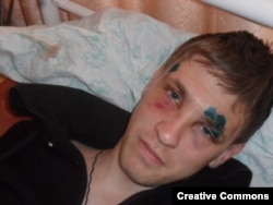 Activist Stepan Chernogubov was beaten after publishing a report about toxic waste.