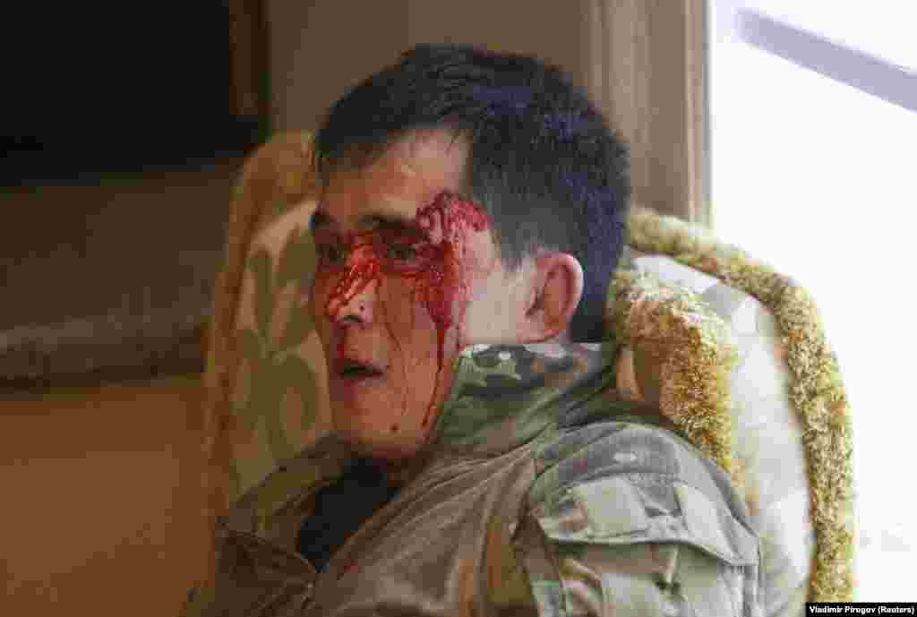 A bloodied member of the Kyrgyz special forces who was injured in the storming of the compound &nbsp;