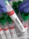 FILE PHOTO: Illustration shows test tubes with "Mpox virus positive" label