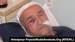 Куртсеїт Абдуллаєв в лікарні
