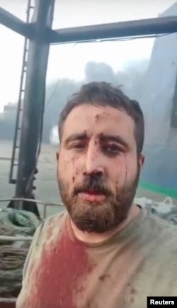 Un membru rănit al echipajului navei „Nadezhda” - imagine de pe rețele sociale.