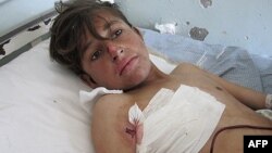 Хлопчик, поранений унаслідок удару в провінції Кунар, 13 лютого 2013 року