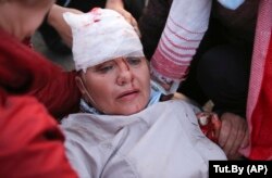 A wounded protester is helped during an opposition rally in Minsk.