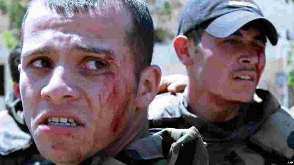 Wounded Syrian soldiers react following a roadside bomb attack that targeted their convoy as they escorted UN peace observers in Daraa. (AFP/Louai Beshara)