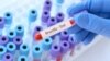 Na dijelu Općine Vogošća pogoršana epidemiološka situacija zbog bruceloze. 
