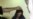 Pakistan Considers Life Sentence For Acid Attacks On Women