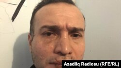 Nicat İbrahim, etiraz olaraq ağzını tikib aclıq aksiyası keçirir, 2 yanvar 2017