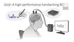 Az agyba beültetett szenzorok segítenek egy mozgássérültnek írni