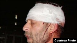 Journalist Edik Baghdasarian suffered severe head injuries.