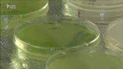 Geni dəyişdirilmiş yosunlar qlobal aclığa son qoya bilər