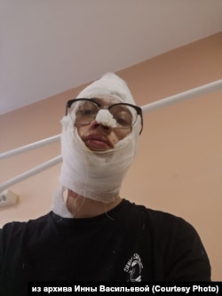 Максим Кокорин, обожженный в машине полиции подросток из Иркутска