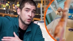 «Я в паніці, не знаю, що робити». Українець втратив ногу на заробітках в Бельгії