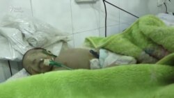 «Тут няма жаўнераў, толькі дзеці» - доктар пра бамбёжкі дзіцячага шпіталя ў Алепа. Відэа