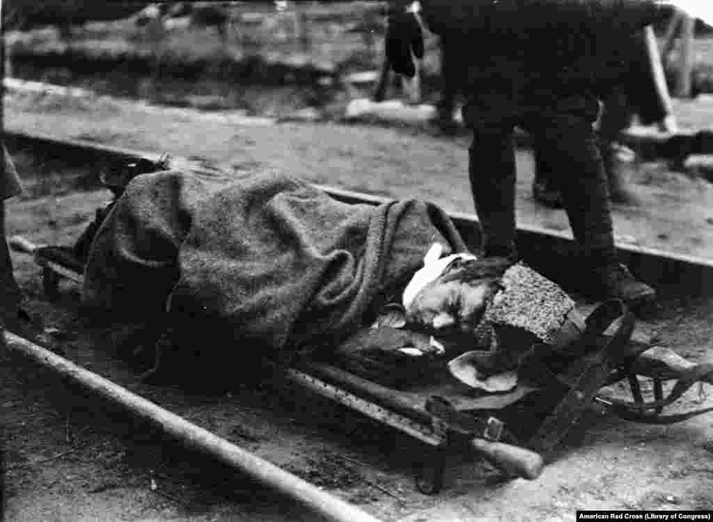 A wounded Bolshevik fighter in 1919