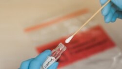 Uzorak za testiranje na korona virus