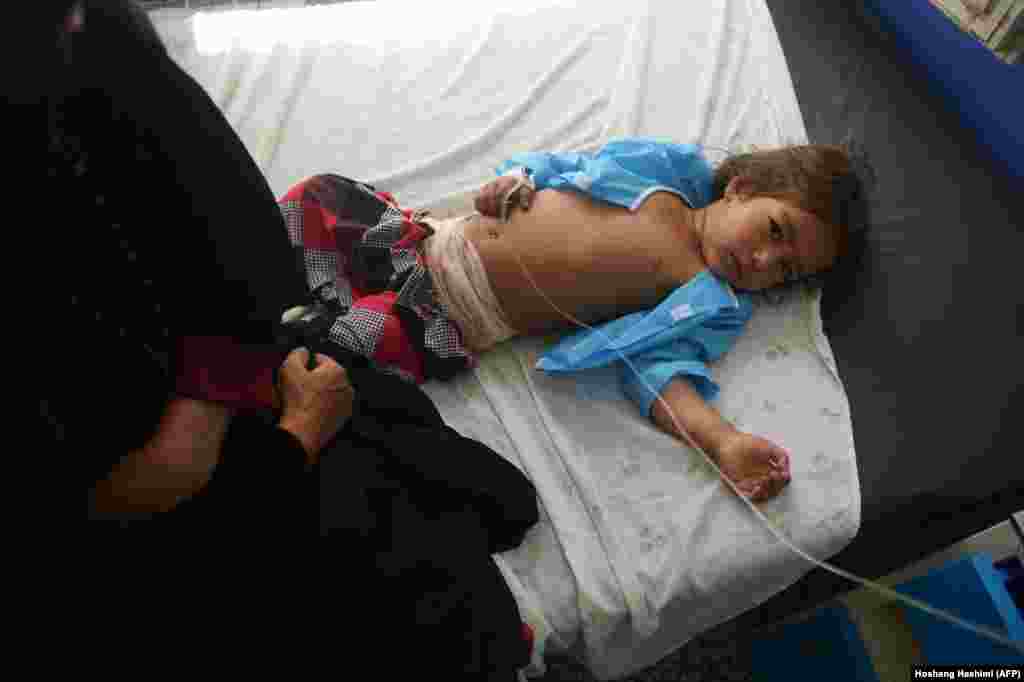 An injured Afghan girl receives treatment at a hospital following an air strike in Herat. Afghan authorities acknowledged that its air force had killed up to 13 civilians, including women and children, in air strikes targeting a Taliban base in the western province of Herat. (AFP/Hoshang Hashimi)