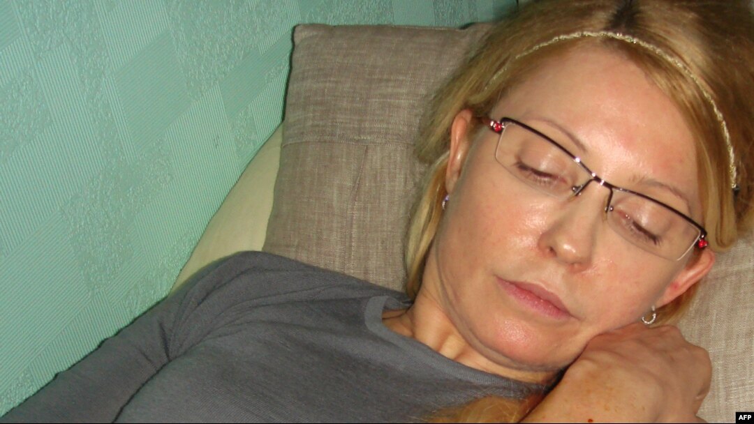 Pictures Of Tymoshenko's Bruises