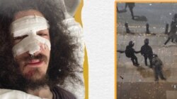 ფოტოკოლაჟი: ზვიად მაისაშვილი კლინიკასა და რუსთაველის გამზირზე