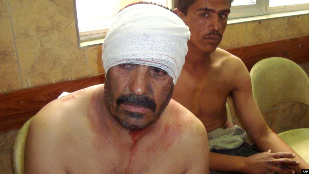 Men injured in the bombing sit bandaged in a Baghdad hospital.