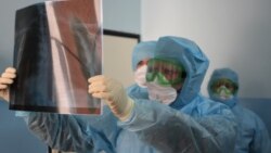 Көрнекі сурет.