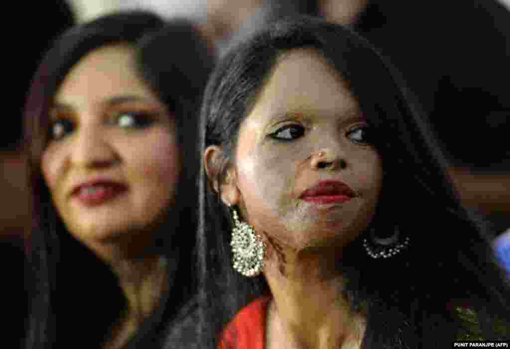 زن هندی که هدف حمله با اسید قرار گرفته، در آستانه روز جهانی زن در کارزار مقابله با اسیدپاشی به زنان.&nbsp;