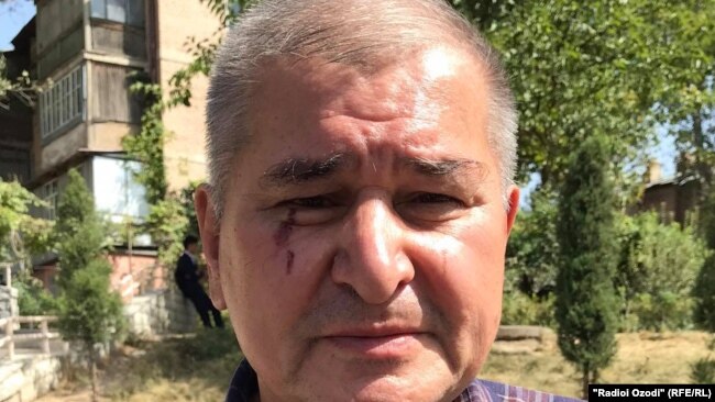 Рахматилло Зойиров после нападения неизвестных лиц, 24 сентября 2020 года