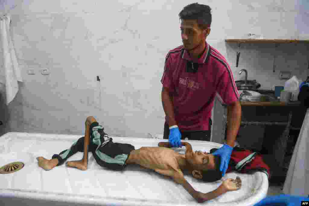 Un medic curăță corpul tânărului palestinian Abdul Jawad al-Ghalban, în vârstă de 14 ani, care a murit de foame la morga spitalului Nasser din Khan Yunis, în sudul Fâșiei Gaza, pe 22 iulie 2025.