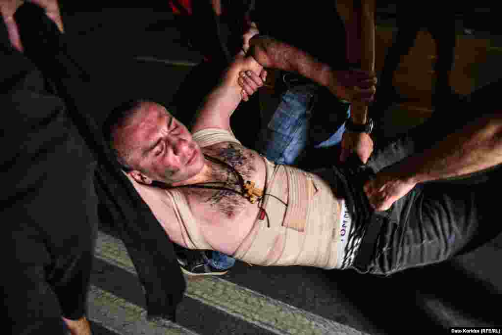 A protester injured during the clashes. 