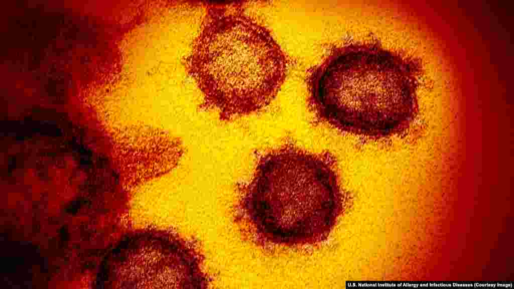 Эти сгруппированные вирионы SARS-CoV-2 (так называется коронавирус) &ndash; полноценные вирусные частицы, которые можно увидеть через электронный микроскоп. Коронавирус нового типа впервые зарегистрировали в китайском городе Ухань в конце 2019 года. По состоянию на 31 марта от коронавирусной инфекции в мире погибло более 38 тысяч человек