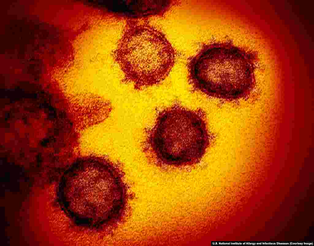 Група на SARS-КоВ-2 (тежок акутен респираторен синдром коронавирус 2) вируси - цели честички на вирусот - гледани преку електронски микроскоп. Новиот коронавирус прв пат беше пријавен во кинескиот град Вухан кон крајот на 2019 година и уби на повеќе од 36.000 луѓе ширум светот заклучно со 30 март. &nbsp;