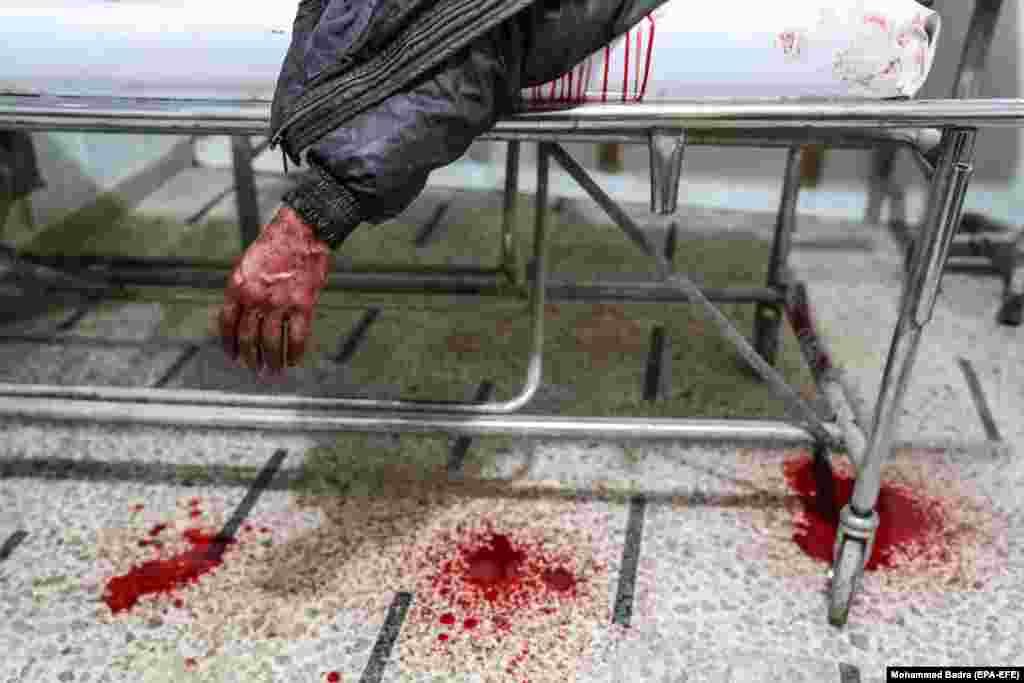 An injured man bleeds as he lies inside a hospital after air strikes on Douma, Syria. Reports said at least 12 people were killed in several air strikes on Douma. (epa-EFE/Mohammed Badra)