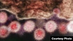 د کانگو ویروس نمونه چې د وینې بحوونکې تبې لامل ګرځي.