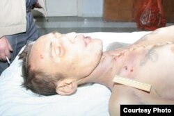 Тело покойного заключенного тюрьмы в Балхаше Сергея Григорьева с ранами. Фото предоставлено матерью погибшего Ларисой Григорьевой. Жезказган, 19 октября 2011 года.