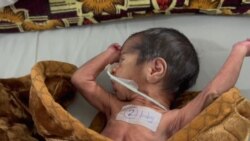 افغانستان یکی از "مرگبار ترین کشورها" برای کودکان و مادران
