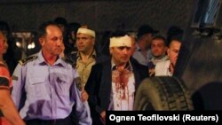 Tokom nasilnog upada pristalica VMRO DPMNE u Sobranje povređeno je više poslanika parlamentarne većine, među njima i Zoran Zaev