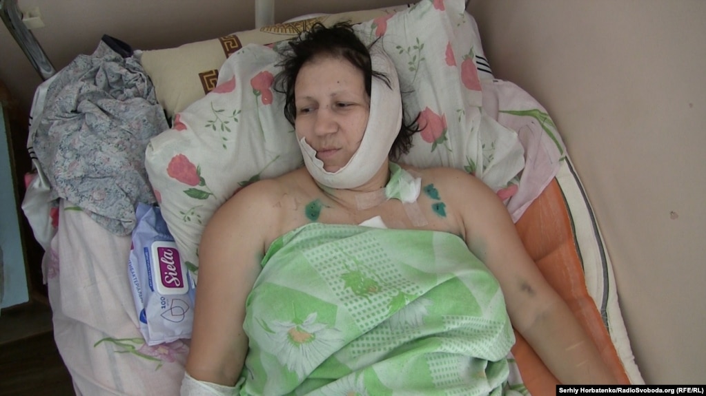Валентина Бучок в больнице после нападения