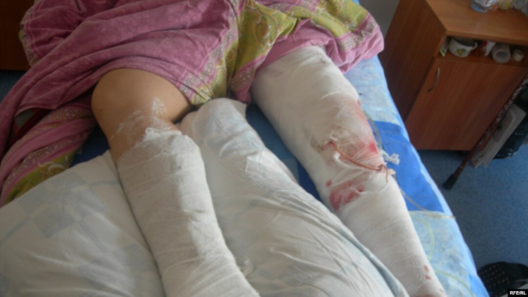 The homemade bomb contained nuts and bolts that injured some 50 people