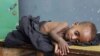 A világon 51 millió két éven aluli gyermek túl alacsony a korához képest az alultápláltság miatt. Ezt az állapotot satnyaságnak nevezik, és ezeknek a gyerekeknek a fele a terhesség alatt vagy élete első hat hónapjában satnyult el. Szomália, Mogadishu, 2011. július 8.
