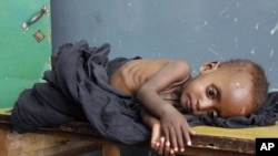 A malnourished child rests at a hospital in Mogadishu.